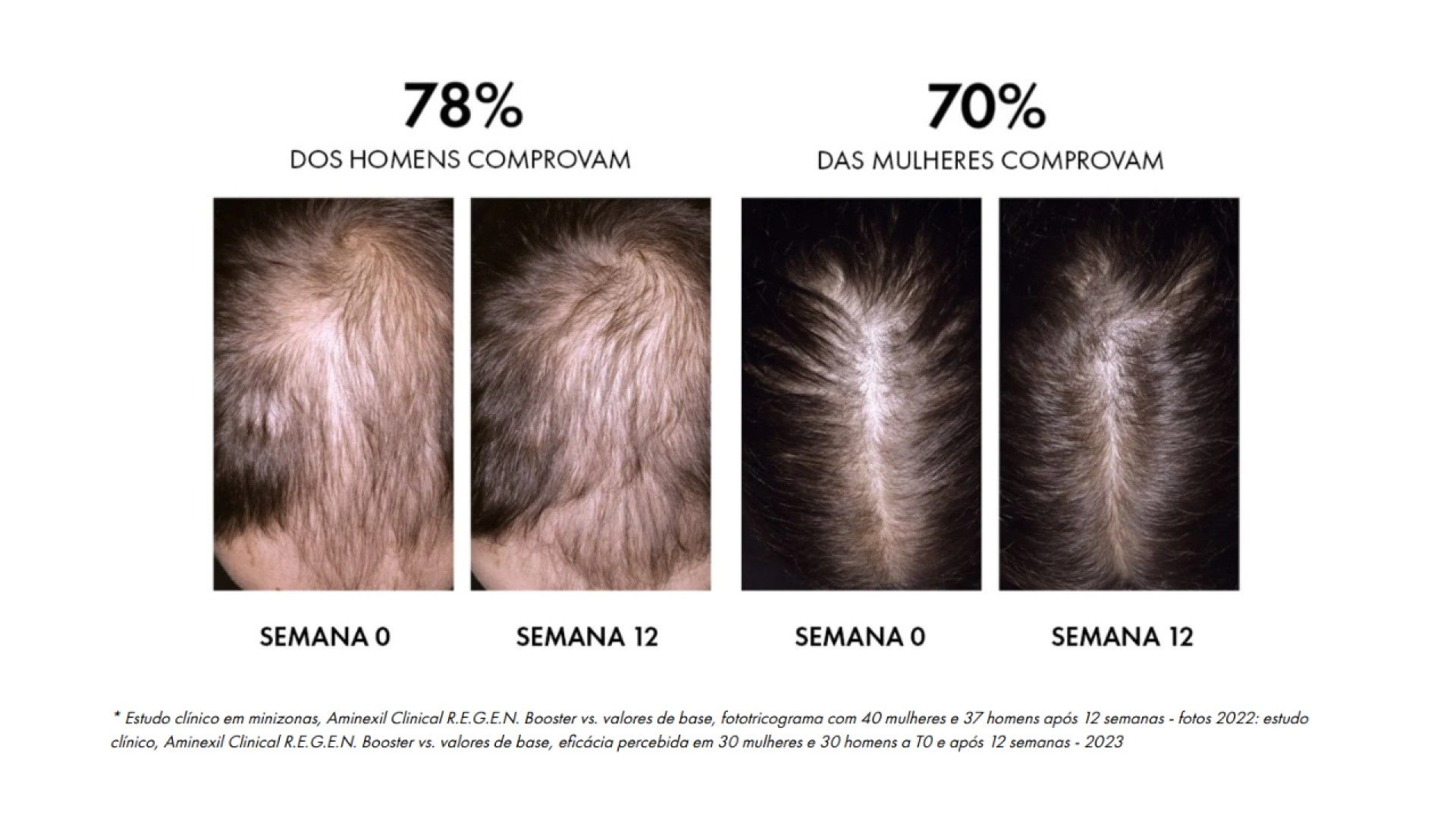 Dercos Aminexil Sérum Regenerador Capilar